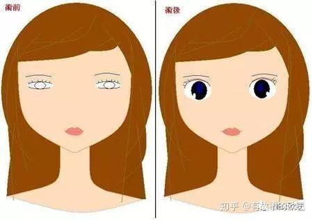 双眼皮电刀_电眼双眼皮手术_双眼手术皮电眼多少钱